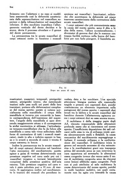 La stomatologia italiana organo ufficiale della Associazione nazionale culturale fascista stomato-odontologica