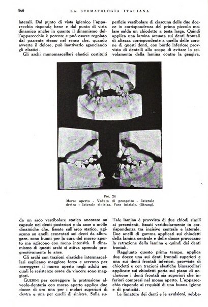 La stomatologia italiana organo ufficiale della Associazione nazionale culturale fascista stomato-odontologica