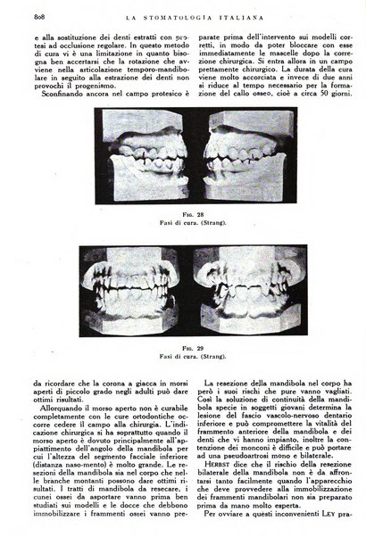 La stomatologia italiana organo ufficiale della Associazione nazionale culturale fascista stomato-odontologica