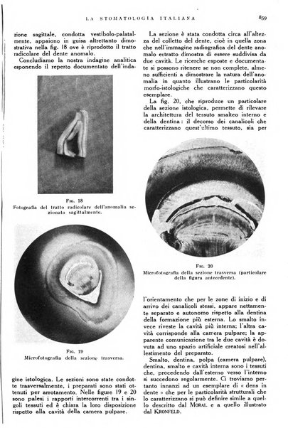 La stomatologia italiana organo ufficiale della Associazione nazionale culturale fascista stomato-odontologica