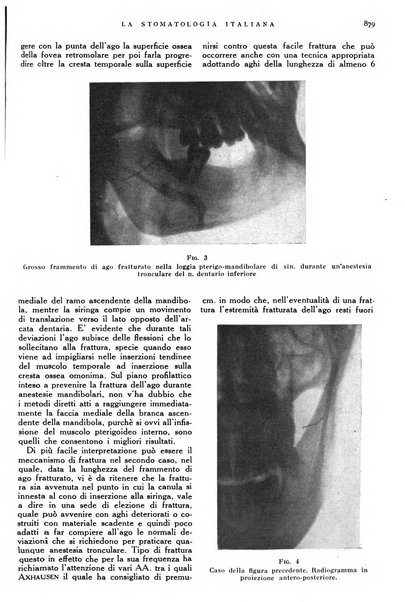 La stomatologia italiana organo ufficiale della Associazione nazionale culturale fascista stomato-odontologica