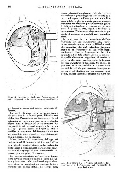 La stomatologia italiana organo ufficiale della Associazione nazionale culturale fascista stomato-odontologica