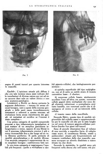 La stomatologia italiana organo ufficiale della Associazione nazionale culturale fascista stomato-odontologica