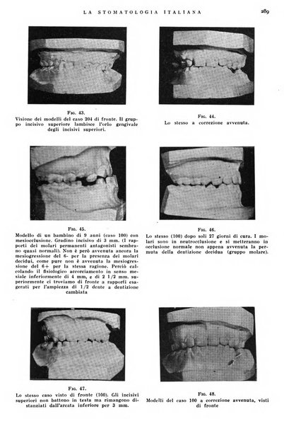 La stomatologia italiana organo ufficiale della Associazione nazionale culturale fascista stomato-odontologica