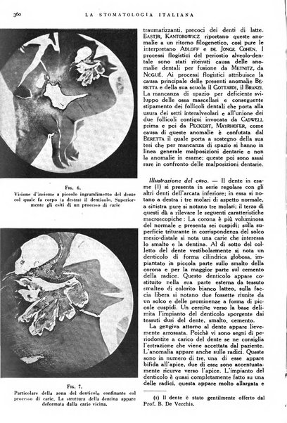 La stomatologia italiana organo ufficiale della Associazione nazionale culturale fascista stomato-odontologica