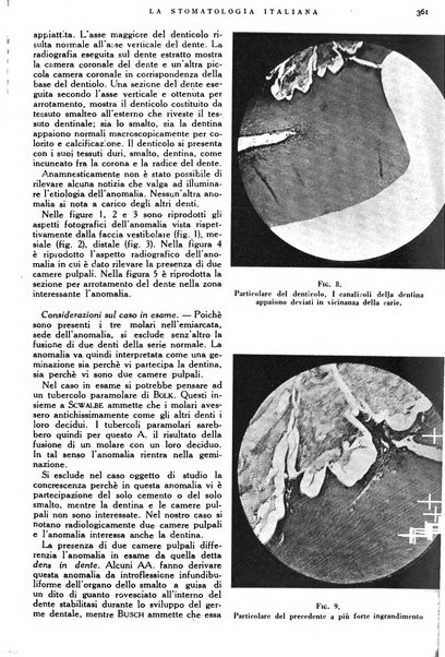 La stomatologia italiana organo ufficiale della Associazione nazionale culturale fascista stomato-odontologica