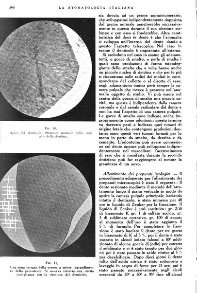 La stomatologia italiana organo ufficiale della Associazione nazionale culturale fascista stomato-odontologica