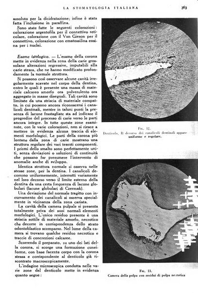 La stomatologia italiana organo ufficiale della Associazione nazionale culturale fascista stomato-odontologica