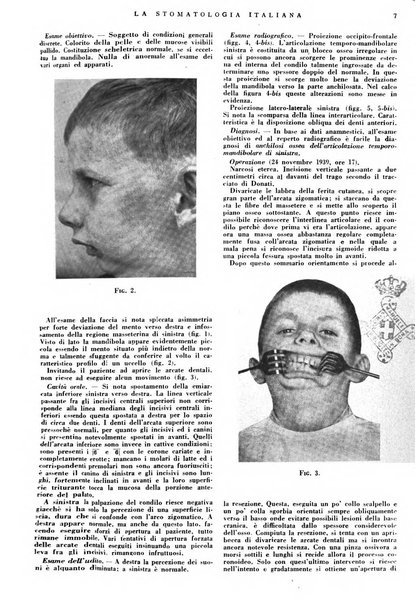 La stomatologia italiana organo ufficiale della Associazione nazionale culturale fascista stomato-odontologica