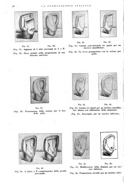 La stomatologia italiana organo ufficiale della Associazione nazionale culturale fascista stomato-odontologica