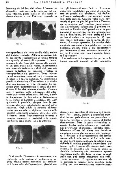 La stomatologia italiana organo ufficiale della Associazione nazionale culturale fascista stomato-odontologica