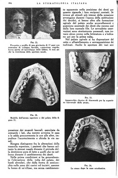 La stomatologia italiana organo ufficiale della Associazione nazionale culturale fascista stomato-odontologica