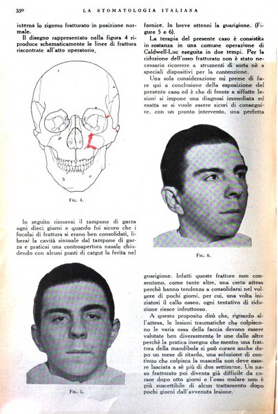 La stomatologia italiana organo ufficiale della Associazione nazionale culturale fascista stomato-odontologica