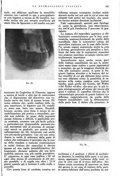 La stomatologia italiana organo ufficiale della Associazione nazionale culturale fascista stomato-odontologica