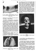 giornale/RML0023157/1942/unico/00000772