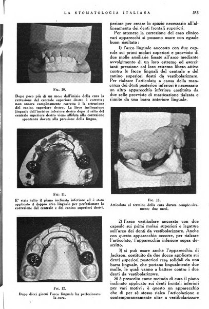 La stomatologia italiana organo ufficiale della Associazione nazionale culturale fascista stomato-odontologica