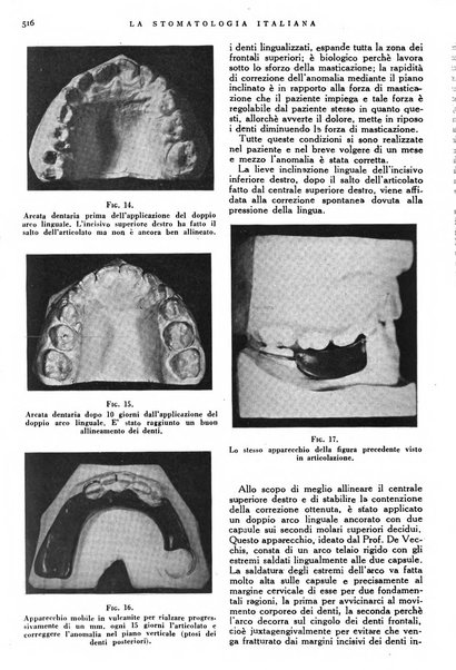 La stomatologia italiana organo ufficiale della Associazione nazionale culturale fascista stomato-odontologica