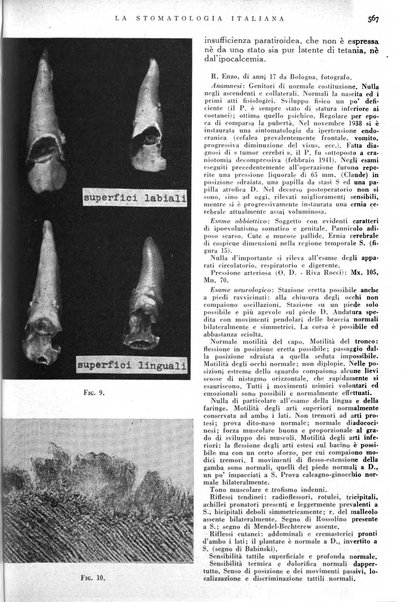 La stomatologia italiana organo ufficiale della Associazione nazionale culturale fascista stomato-odontologica