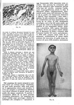 giornale/RML0023157/1942/unico/00000857