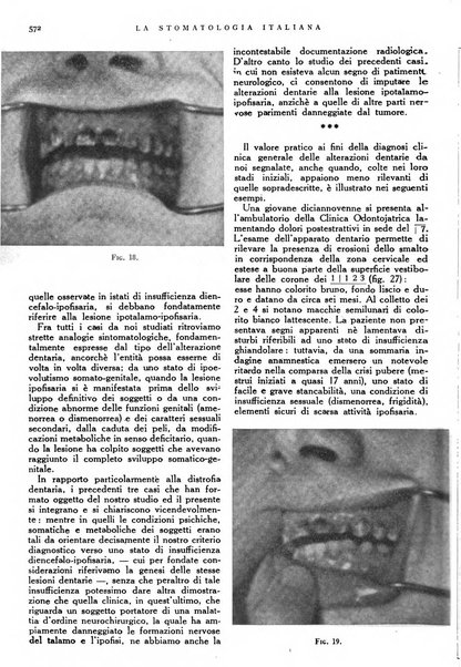 La stomatologia italiana organo ufficiale della Associazione nazionale culturale fascista stomato-odontologica