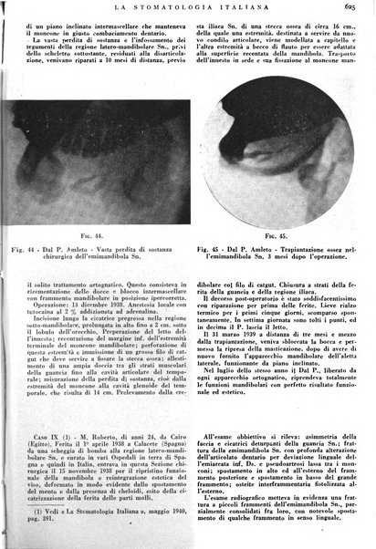 La stomatologia italiana organo ufficiale della Associazione nazionale culturale fascista stomato-odontologica