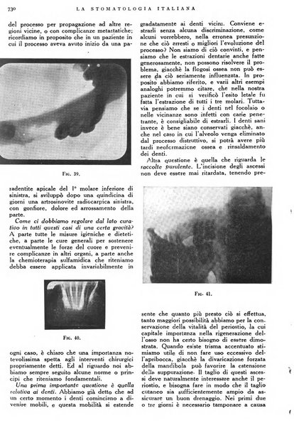 La stomatologia italiana organo ufficiale della Associazione nazionale culturale fascista stomato-odontologica