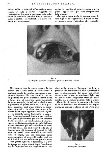 La stomatologia italiana organo ufficiale della Associazione nazionale culturale fascista stomato-odontologica