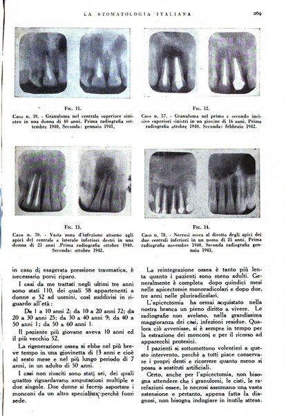 La stomatologia italiana organo ufficiale della Associazione nazionale culturale fascista stomato-odontologica