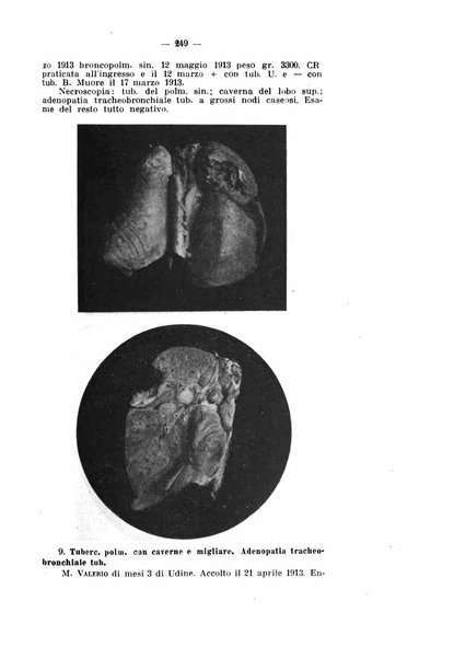 Tubercolosi giornale di studi e di lotta antitubercolare