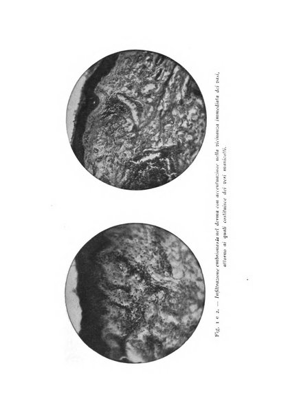 Tubercolosi giornale di studi e di lotta antitubercolare