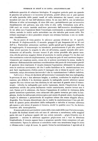 Tubercolosi giornale di studi e di lotta antitubercolare