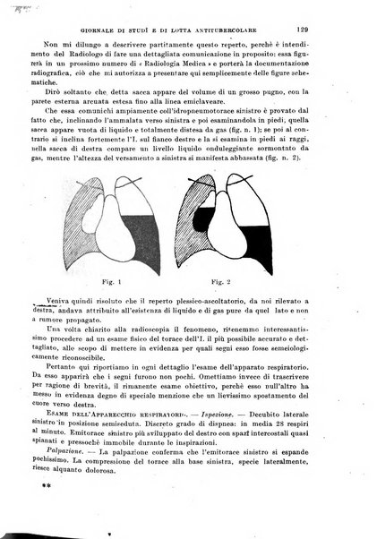 Tubercolosi giornale di studi e di lotta antitubercolare