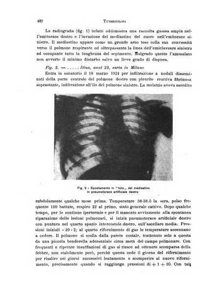 Tubercolosi giornale di studi e di lotta antitubercolare