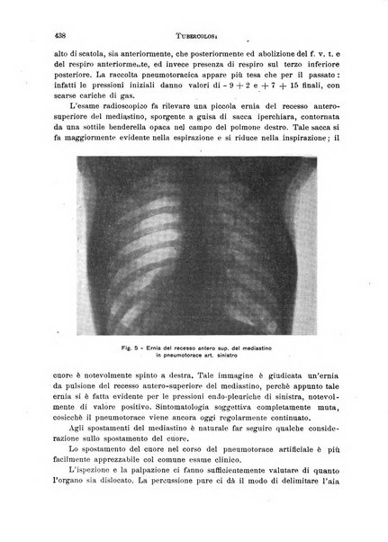 Tubercolosi giornale di studi e di lotta antitubercolare