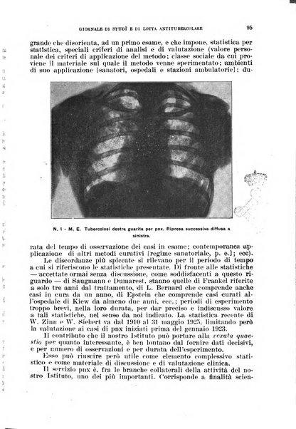 Tubercolosi giornale di studi e di lotta antitubercolare