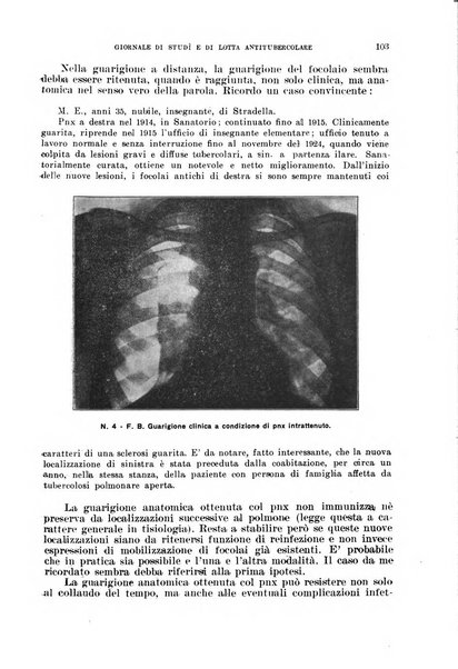 Tubercolosi giornale di studi e di lotta antitubercolare