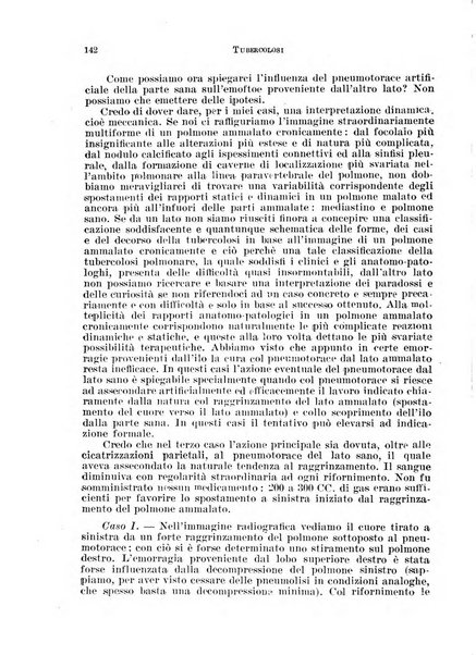 Tubercolosi giornale di studi e di lotta antitubercolare