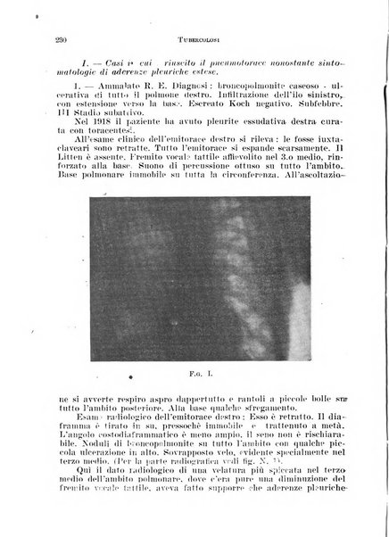 Tubercolosi giornale di studi e di lotta antitubercolare