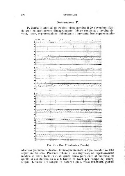 Tubercolosi giornale di studi e di lotta antitubercolare