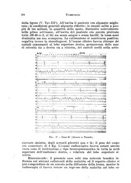 Tubercolosi giornale di studi e di lotta antitubercolare