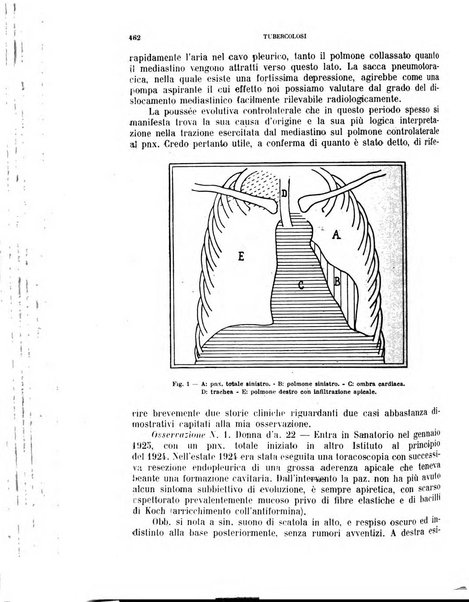 Tubercolosi giornale di studi e di lotta antitubercolare