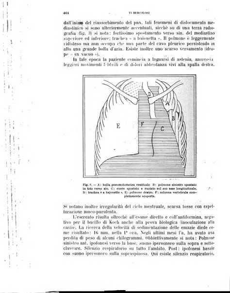 Tubercolosi giornale di studi e di lotta antitubercolare