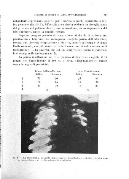 Tubercolosi giornale di studi e di lotta antitubercolare