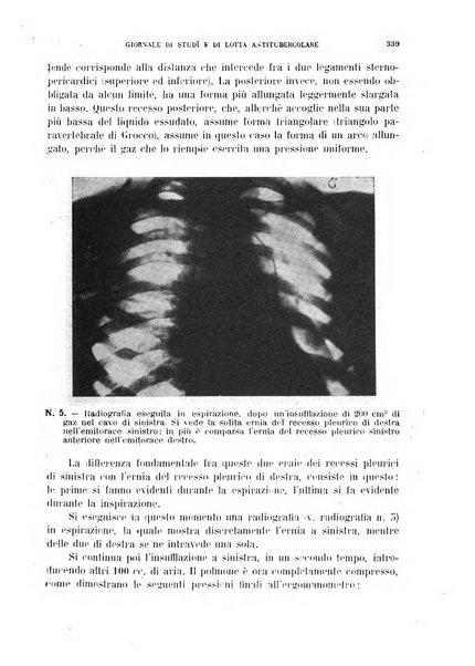 Tubercolosi giornale di studi e di lotta antitubercolare