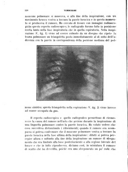 Tubercolosi giornale di studi e di lotta antitubercolare