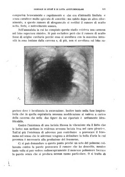 Tubercolosi giornale di studi e di lotta antitubercolare