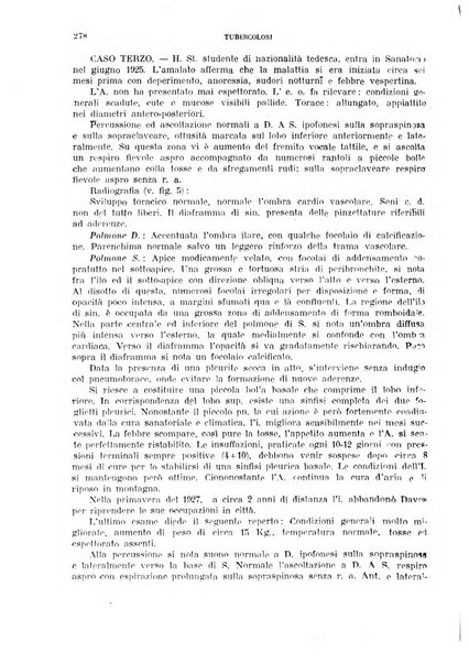 Tubercolosi giornale di studi e di lotta antitubercolare