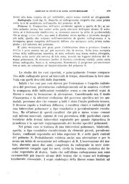 Tubercolosi giornale di studi e di lotta antitubercolare