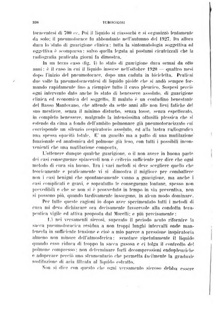 Tubercolosi giornale di studi e di lotta antitubercolare