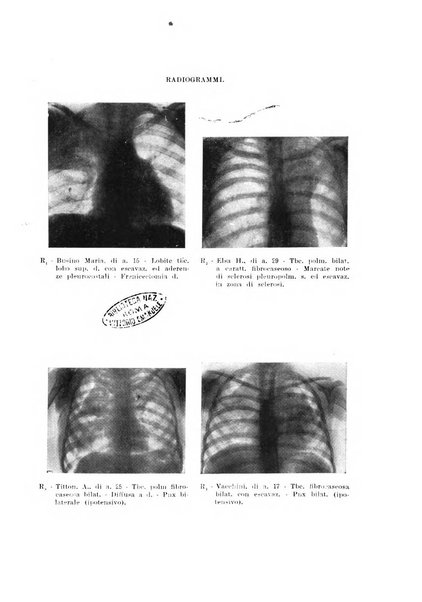 Tubercolosi giornale di studi e di lotta antitubercolare